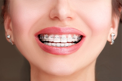 Orthodontiste Ambérieu