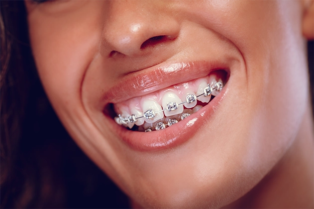 Orthodontiste Ambérieu