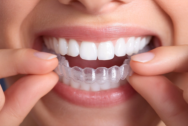 Orthodontiste Ambérieu